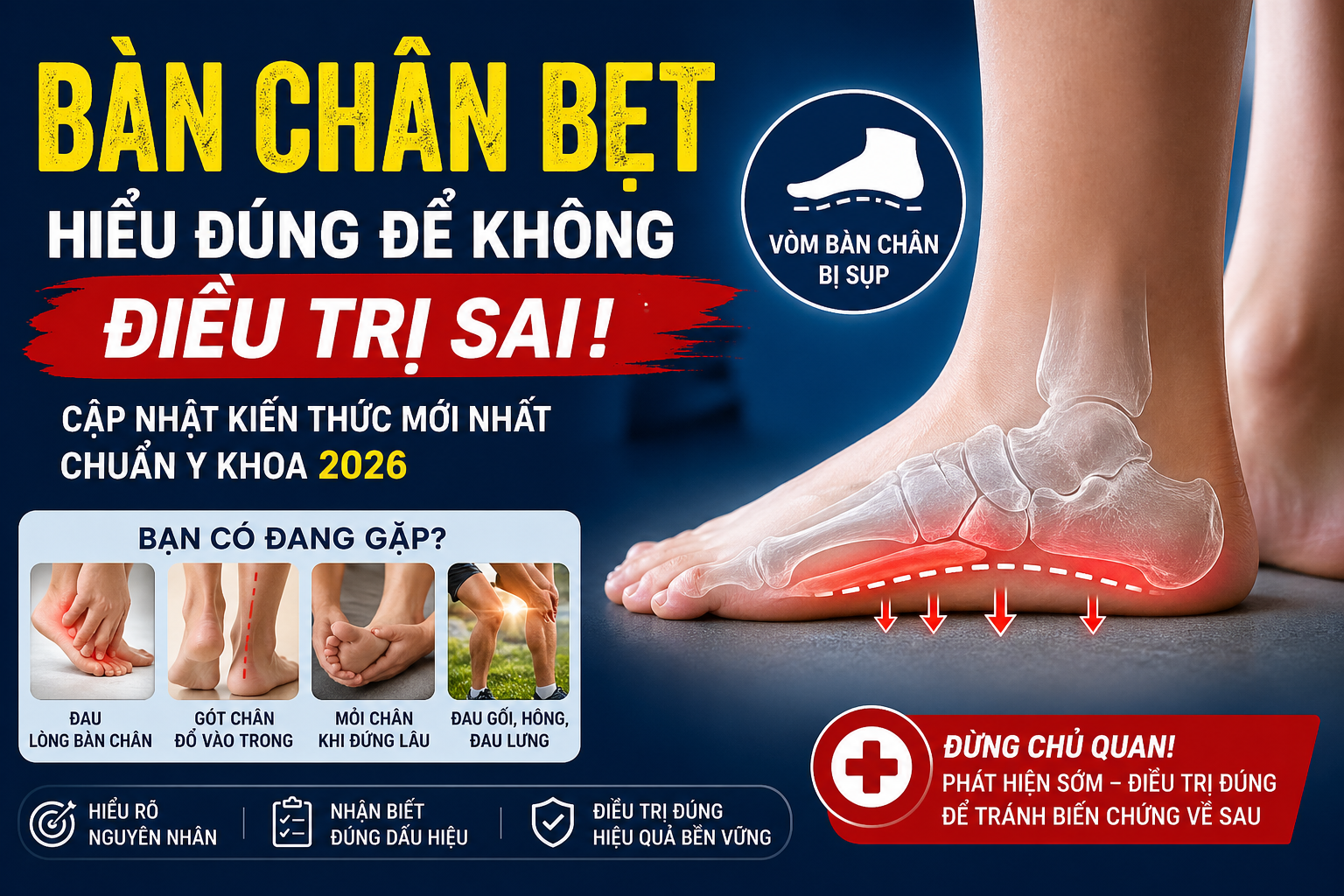 BÀN CHÂN BẸT- HIỂU ĐÚNG ĐỂ KHÔNG ĐIỀU TRỊ SAI